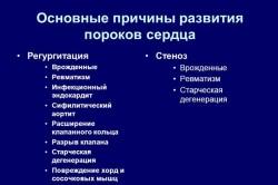 Лікування пролапса мітрального клапана (пмк)