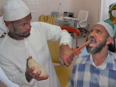 Лікування зубів під загальним наркозом
