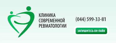 Малахов АіФ розпрощався з болем в суглобах