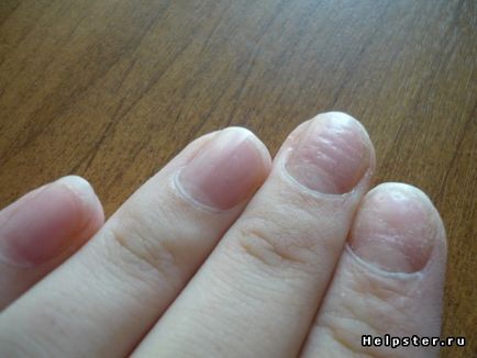 Manichiura pentru unghiile cu probleme (unghiile înfricoșătoare din interior)