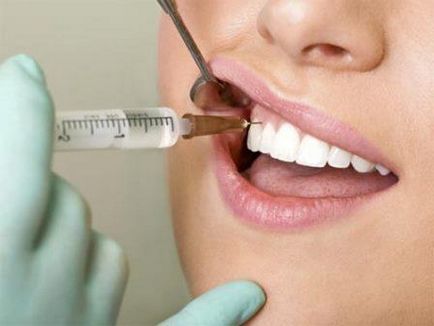 Чи можна при місячних лікувати зуби ви запитували - ми відповідаємо