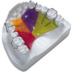 Платівка для зубів коли і як застосовується, переваги і недоліки