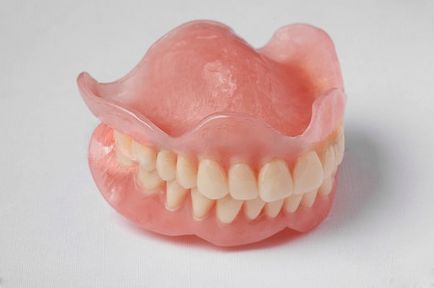 Пластмасові зубні протези види, ціна, фото