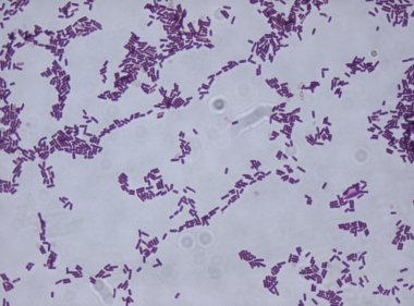 Megszerzése kultúra széna bacillus Bacillus subtilis