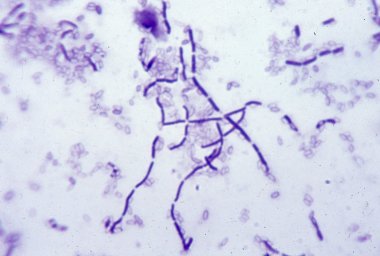 Megszerzése kultúra széna bacillus Bacillus subtilis