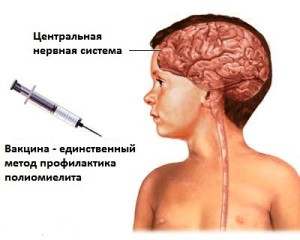 Diareea după vaccinarea acneei și poliomielitei la un copil, vărsături, temperatură, scaune libere
