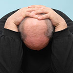 Cauzele alopeciei, clinicii medicale