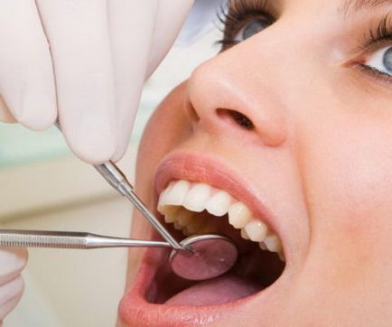 Nyaki fogszuvasodás - etiológiájú besorolás és a legfontosabb terápiák