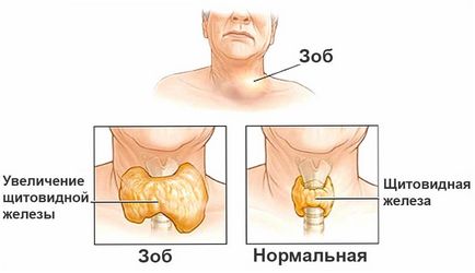 Синці на ногах без причини у жінок - причини появи