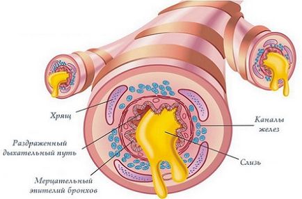 Szirup édesgyökér köhögés hasznos tulajdonságai és alkalmazásai