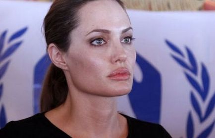 Smilia Angelina Jolie este bolnavă de hepatită c - are nevoie de un transplant de ficat.