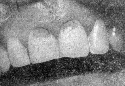 Manifestări dentare ale buruienilor toxici difuzați - miere dr