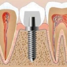 Stomatologie Hunchun preturi