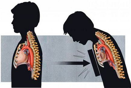 Contuzii de vindecare pulmonară, simptome și prim ajutor