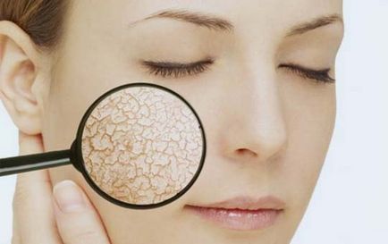 Догляд за сухим типом шкіри обличчя основні рекомендації і домашні засоби