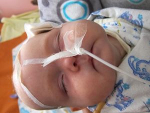 Ventriculită (ependimită) la nou-născuți, tratament, efecte