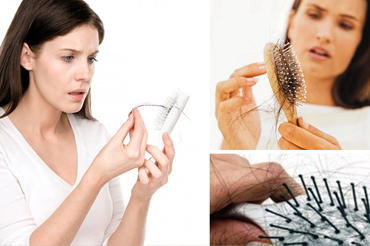 Випадання волосся у жінок - причини і лікування