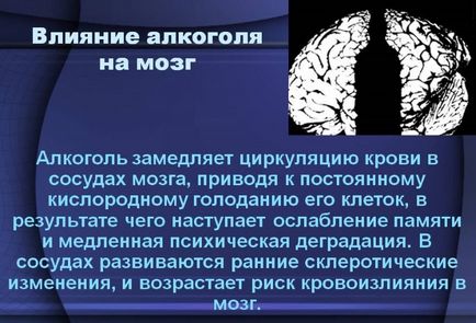 Вплив алкоголю на мозок людини