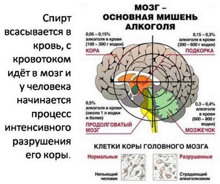 Efectul alcoolului asupra creierului uman