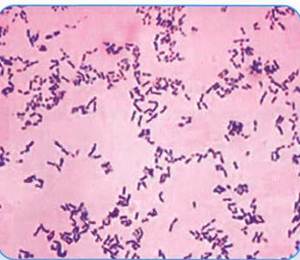 Збудник дифтерії (corynebacterium diphtheriae)