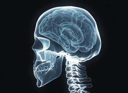 Chordoma craniu simptome de baza, diagnostic, tratament, predictii