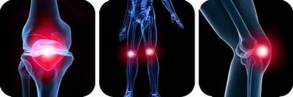 Tratamentul bolii articulației genunchiului