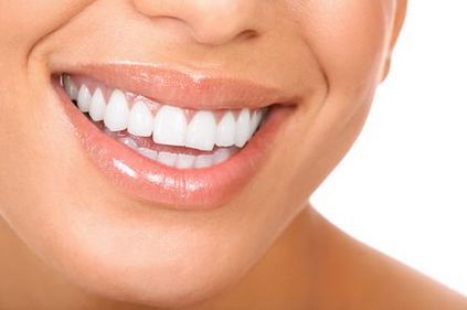 Brilliant smile - косметичне відбілювання зубів