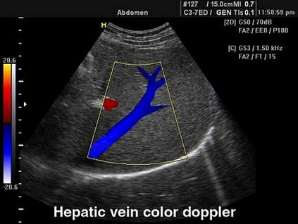 Diagnosticul cancerului