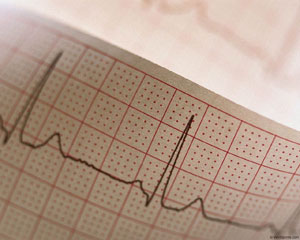 ECG la domiciliu, electrocardiografie în Mytischi