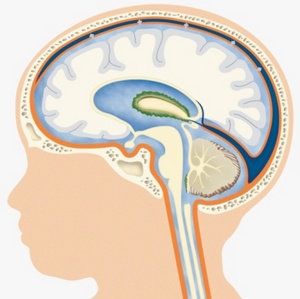 Гідроцефалія головного мозку у новонароджених - методи лікування і чим загрожує для малюка
