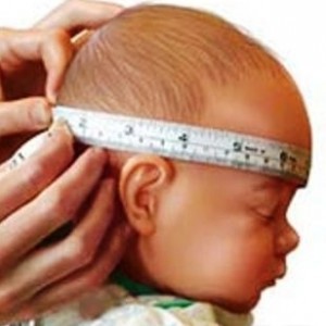 Hidrocefalia creierului la nou-născuți - metode de tratament și ceea ce este plin de copil