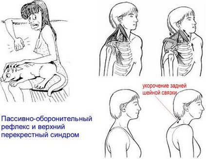 Principalul mușchi al unui muschi romboid, anti-stomac, dr. Andrei Belovezhkin, despre resursele de sănătate
