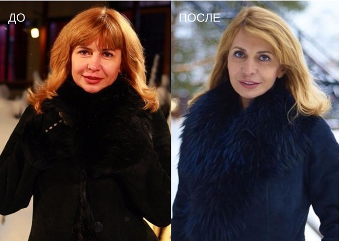 Irina Agibalova înainte și după operația plastică