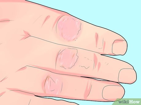 Cum să folosiți ulei de oregano cu beneficii pentru sănătate