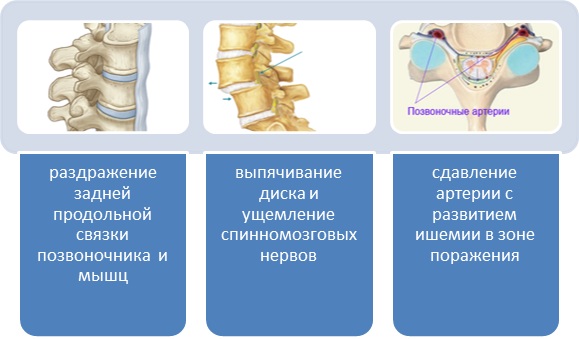 Як лікувати біль у попереку