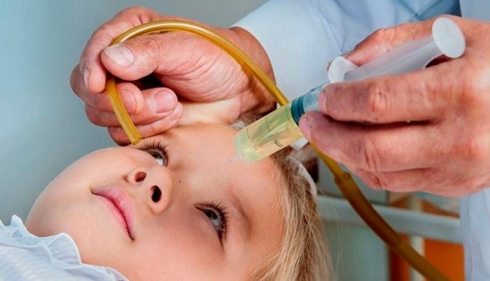 Як лікувати синусит у дитини