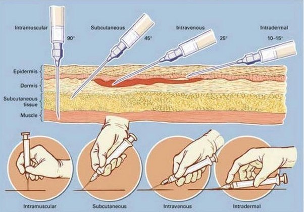 Cum să faceți injecții informații importante! Smilepub