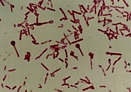 Intervalul de incubație intestinală - simptomele escherichiozei, cauzele, diagnosticul, tratamentul și nu