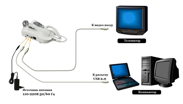 Комплексна система trichologic - комплекс для діагностики волосся (камера aramo sg і комп'ютерна