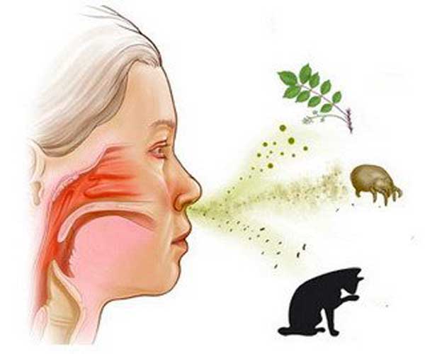 Лікування алергії в клініці «Ківач»