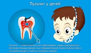 Tratamentul pulpitei dinților sugarilor la copii, parodontita la copii