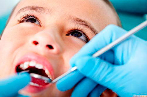 Лікування пульпітів і періодонтитів зубів у дітей