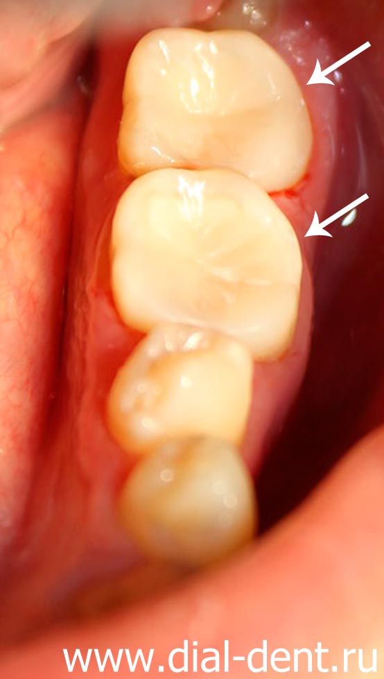 Tratamentul stomatologic cu microscop