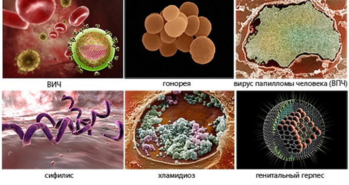 Leucocitele în norma și patologia ginecologică a frotiurilor