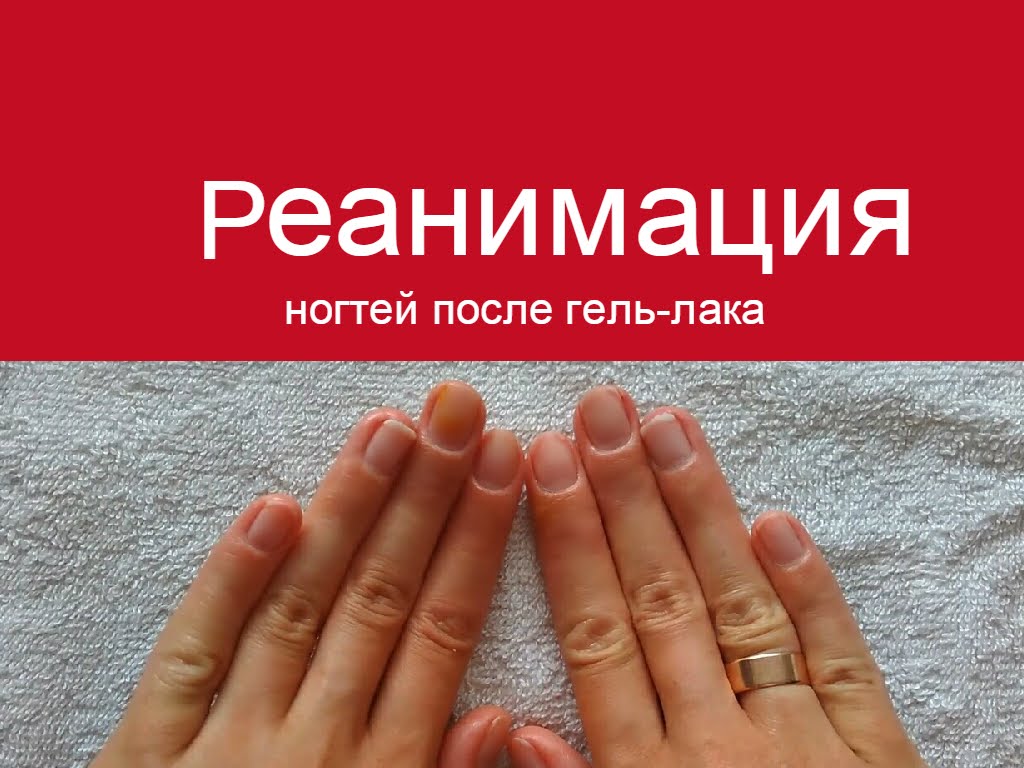 Manikűr gél lakk kāds c AliExpress! Sikerült legyőzni az allergia! (Manikűr) Manikűr gél lakk kāds c AliExpress! Sikerült legyőzni az allergia!