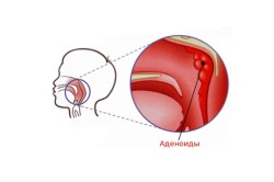 Copilul sfârșește într-un vis motivele, tratamentul, prevenirea (video)