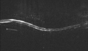 MRI gerinc betegségek, vettsentr cikk