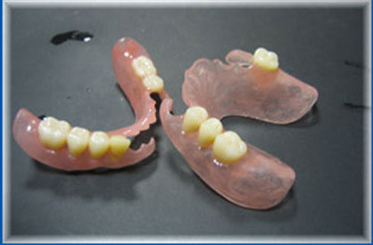 Protezele dentare detașabile din nylon - neajunsuri și avantaje ale protezelor din nailon, private