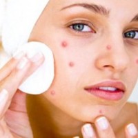 Noutatea în domeniul cosmetologiei - curățarea hidrafacială