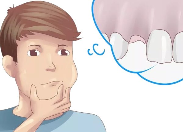 Пухлина після видалення зуба причини появи, що це означає і як лікувати